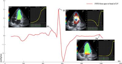 Time domain adaptation of left ventricular diastolic intraventricular pressure in elite female ice hockey athletes